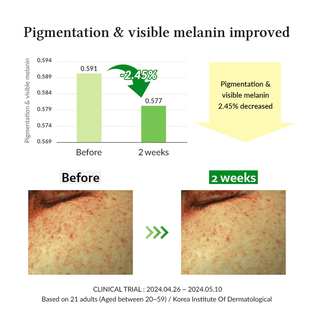 Dr. Althea – Gentle Vitamin C Serum (30ml)