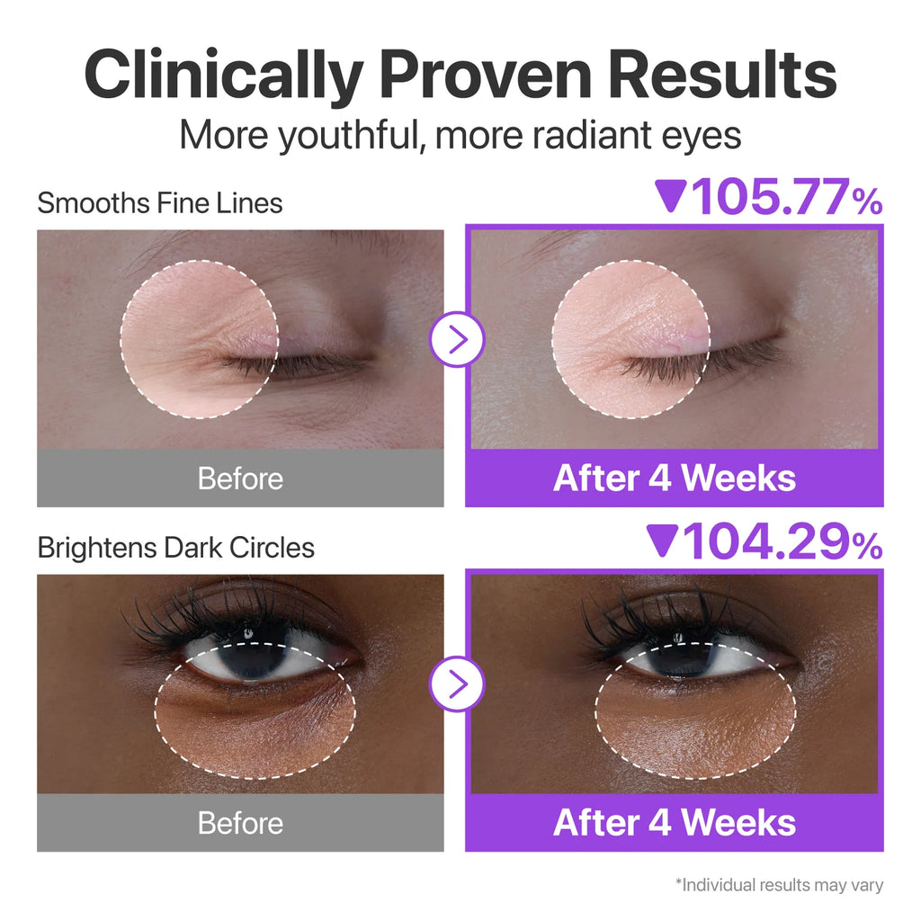 Numbuzin – No.9 NAD+ Retinol Volumetox Eye Cream (10ml)