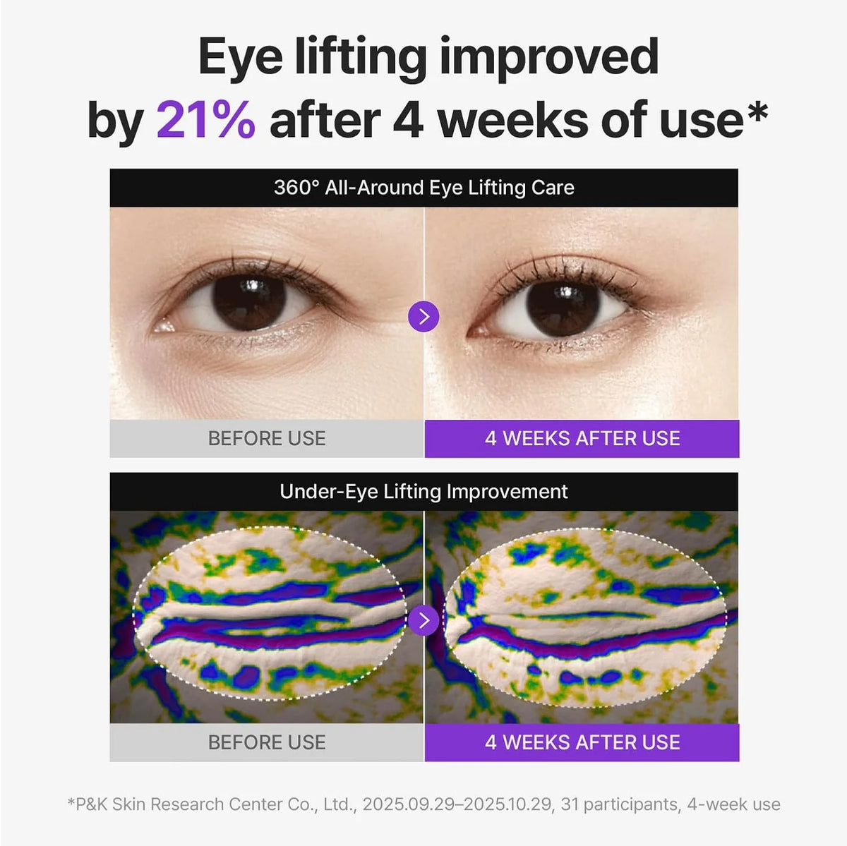Centellian24 - 360º Shot PDRN lifting Eye cream 30ml